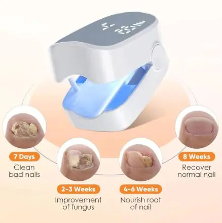 Nail Care Laser Device detail