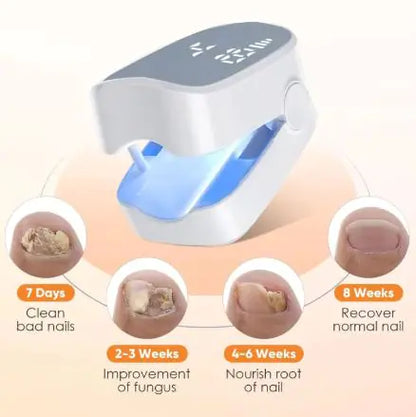 Nail Care Laser Device detail