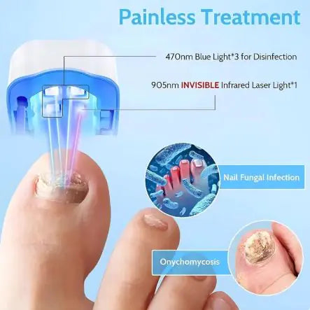 Nail Care Laser Device results